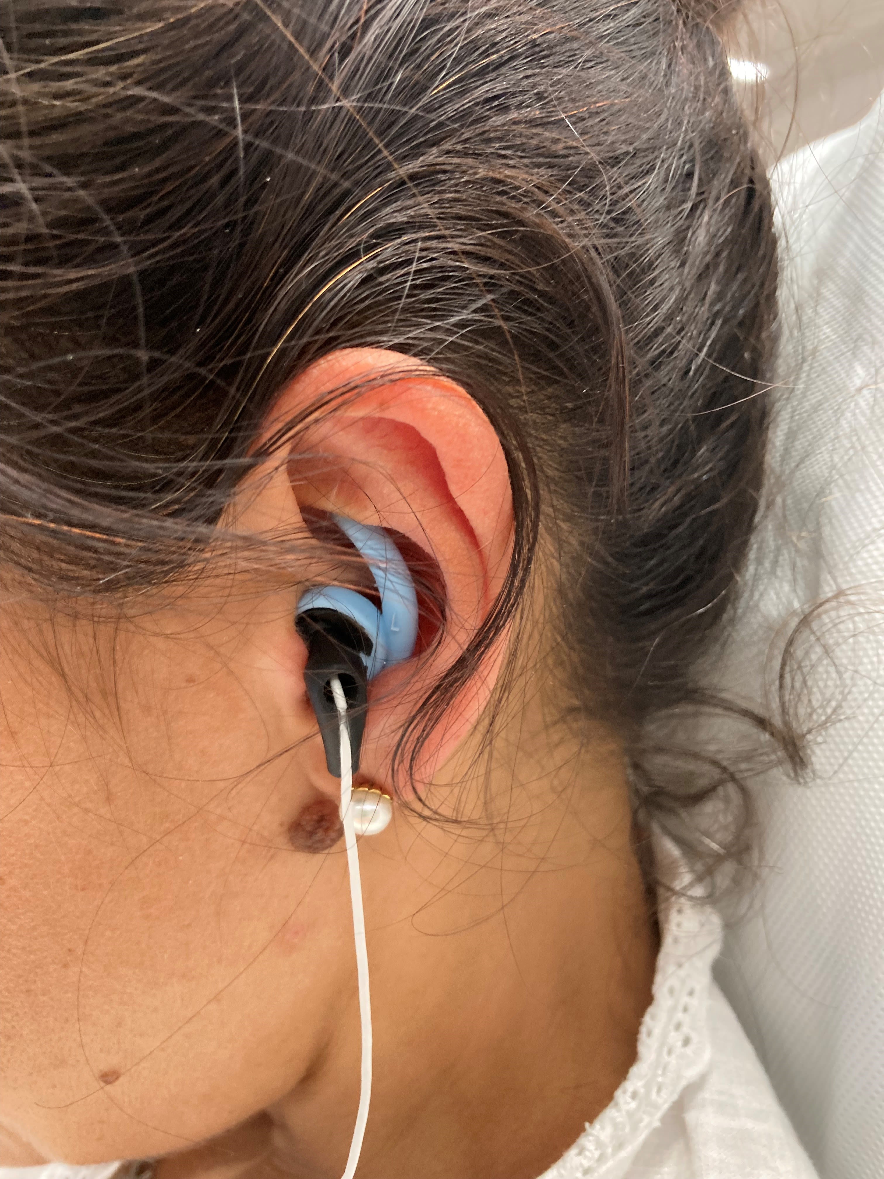 An ear wearing an earbud-like device